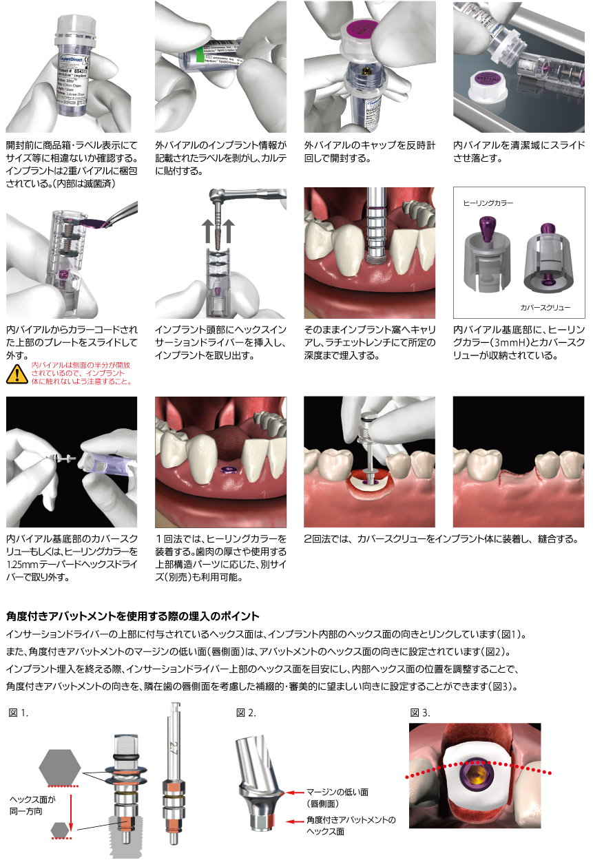 外科術式マニュアル 株式会社インプラテックス