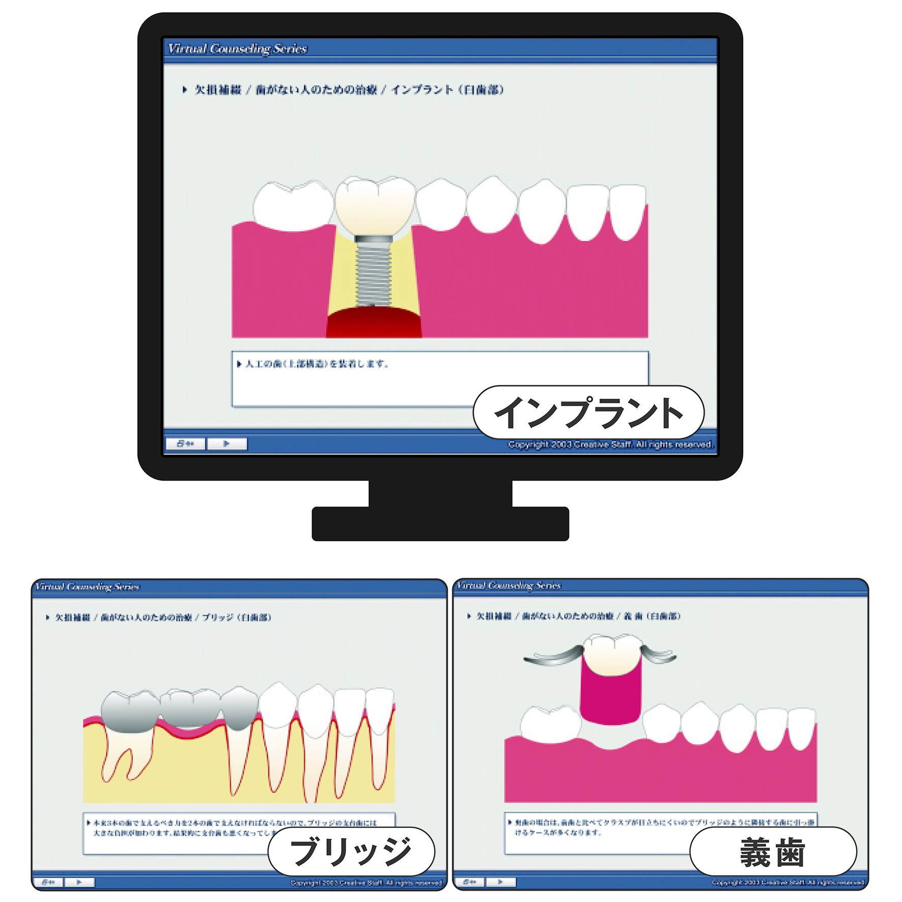 ヴァーチャルカウンセリングDVD