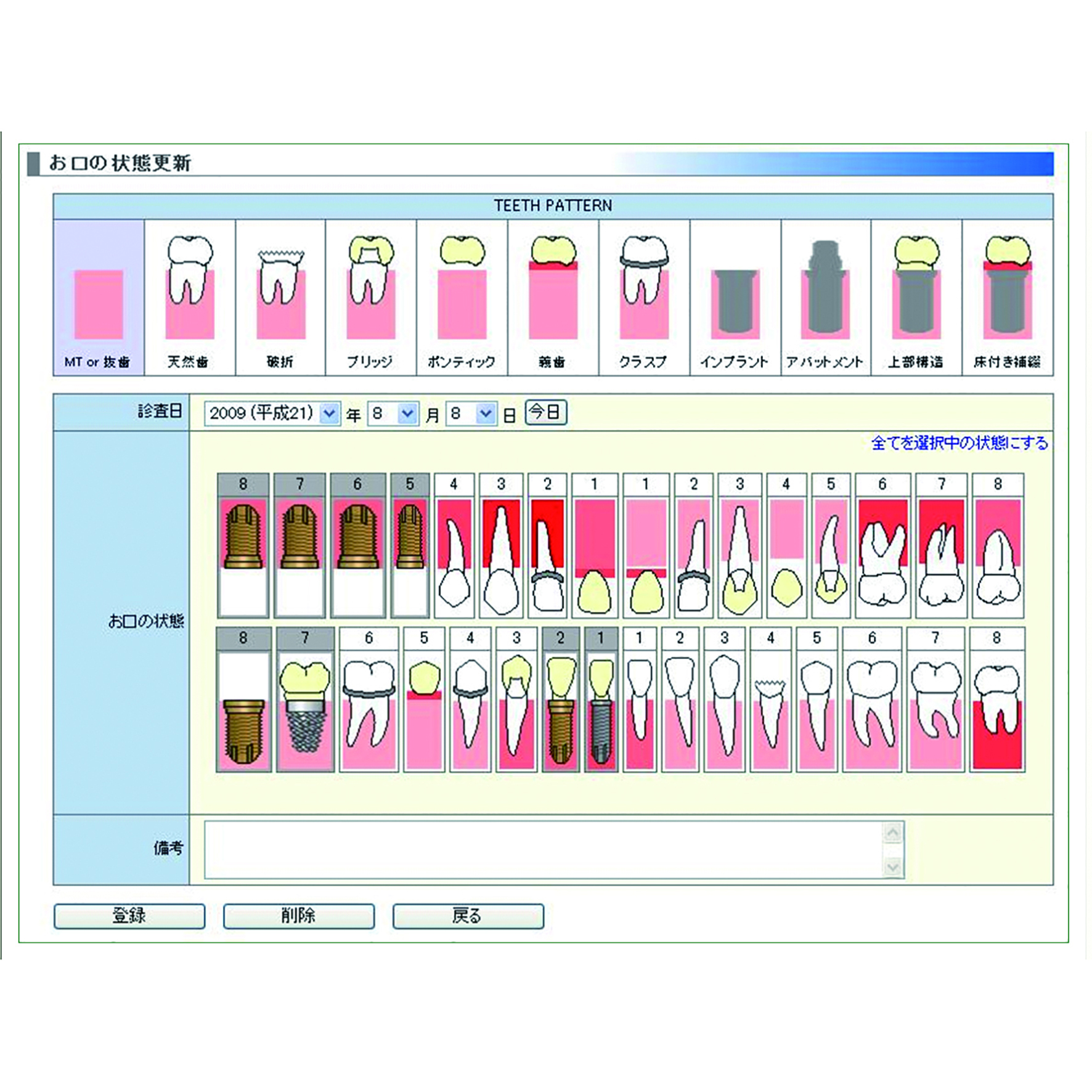 Implant Navigator for Network 初期設定料