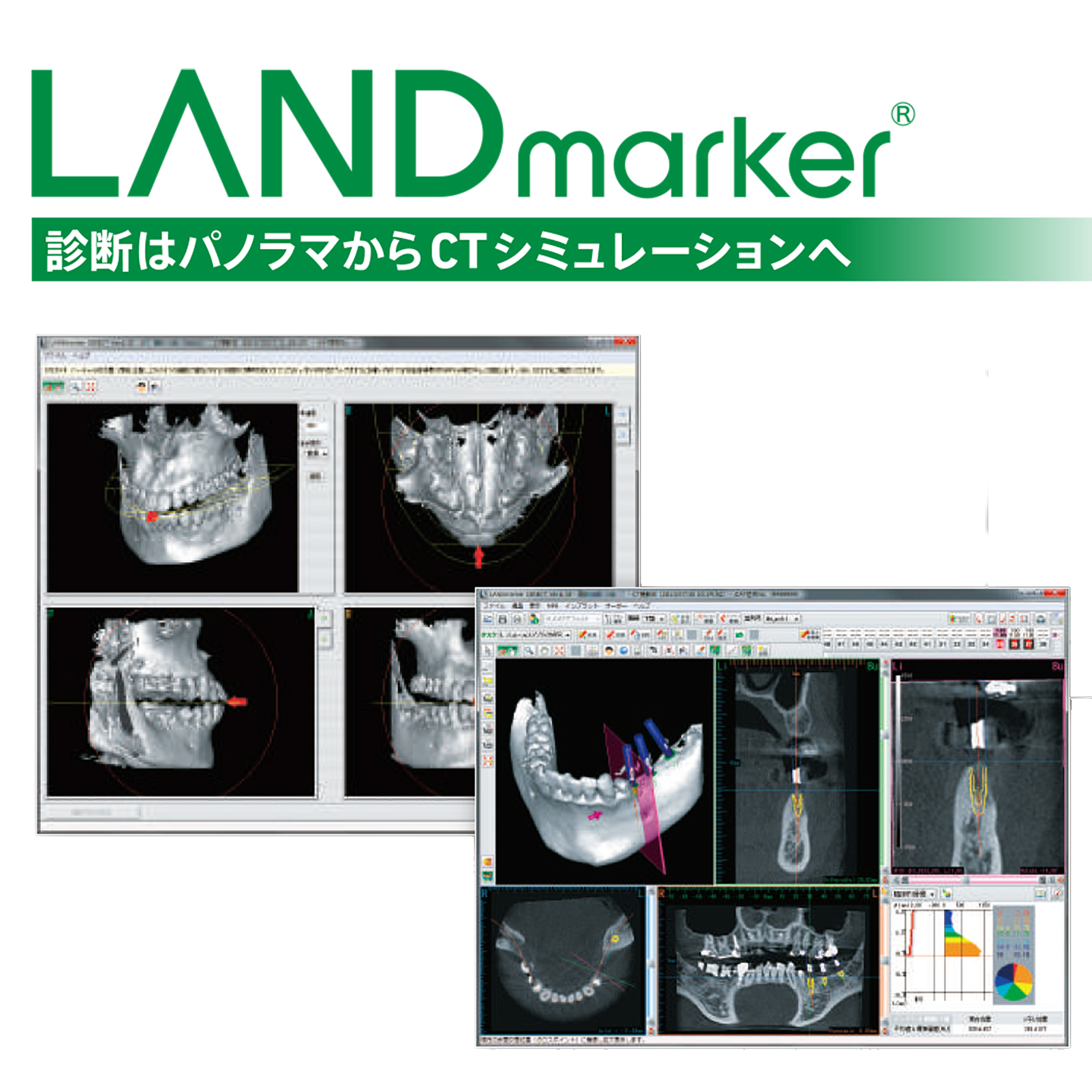 ランドマーカー（LANDmarker）のご案内